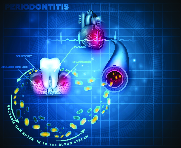 The Relationship Between Gum Disease and Heart Disease