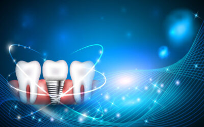 The Evolution Of Dental Implants