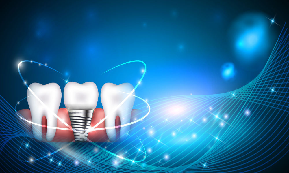 Joliet Dental Implants