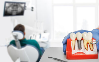 What Is The Process For Getting Dental Implants In Joliet?
