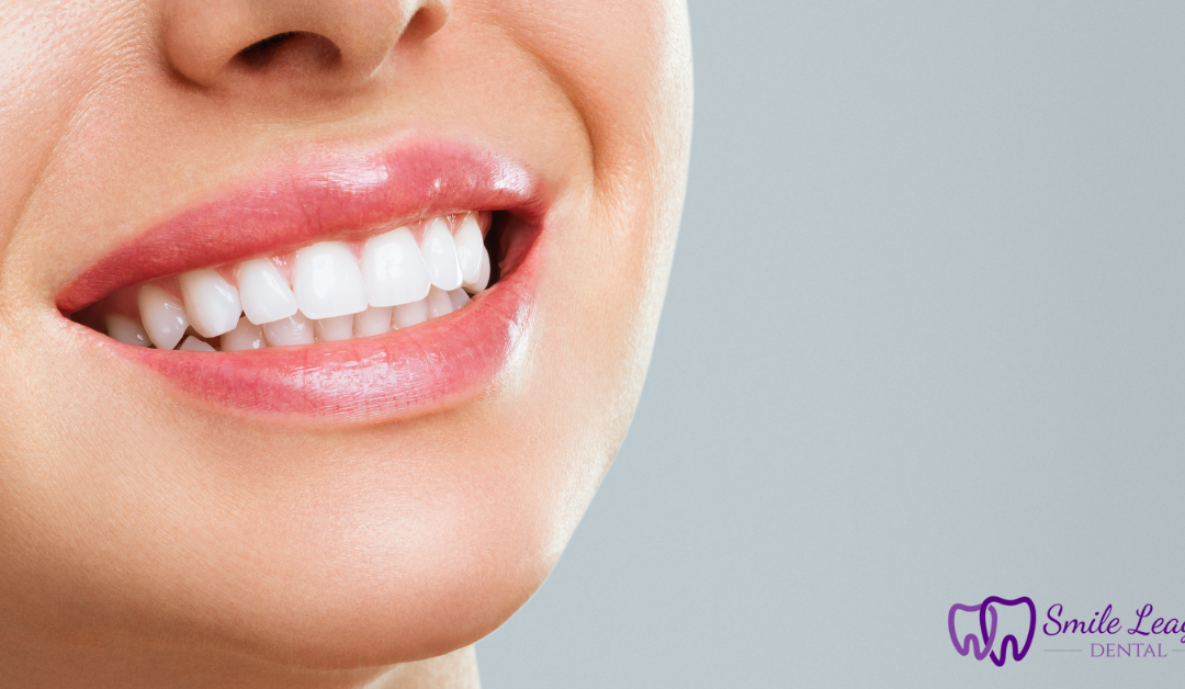 DIY teeth whitening products like lemon slices and hydrogen peroxide, highlighting the risks of home whitening methods.