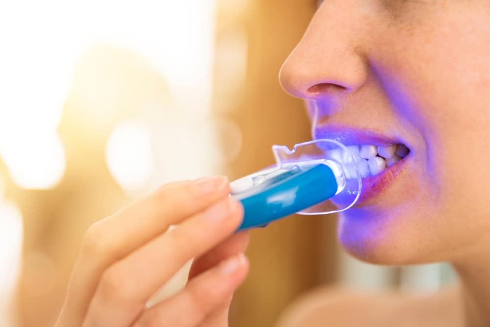 WomanIsWhiteningTeethWithSpecialToothpasteAndLedLight
