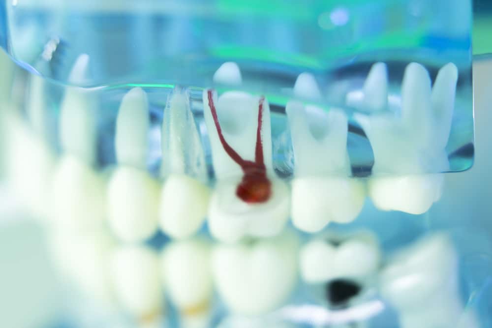 DentalTeethMouthGumsDentistsTeachingModelShowingEachTooth