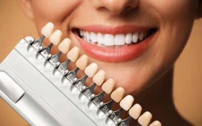 Dental Veneers Vs. Bonding: Which Cosmetic Option Is Right For You?
