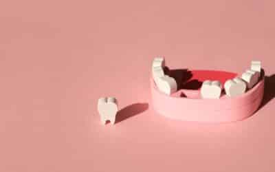 How Missing Teeth Affect Your Jaw And Facial Structure