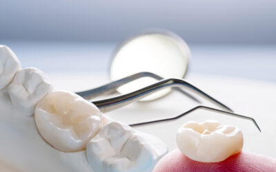 What To Expect During A Dental Crown Procedure