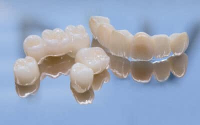 Dental Bridges Vs. Dental Implants: How To Replace Missing Teeth